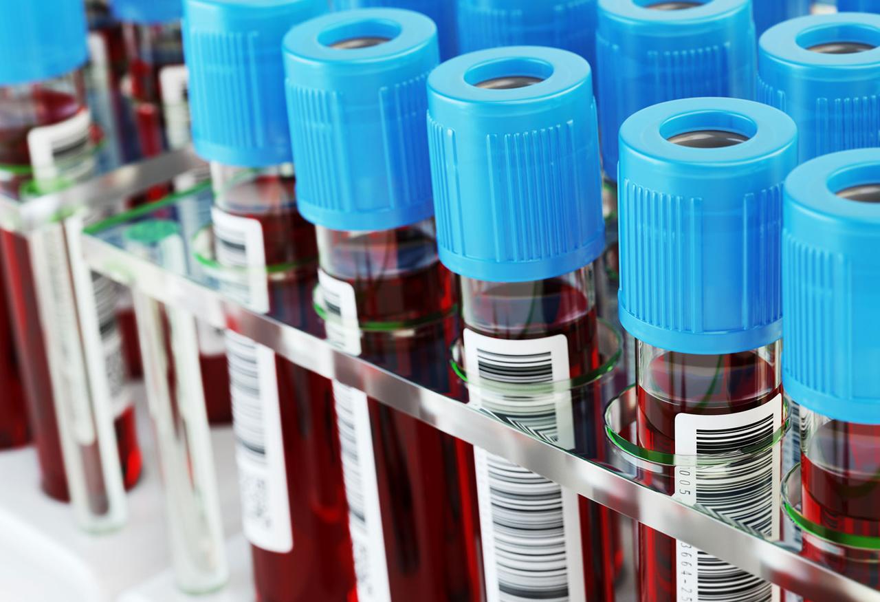 a close up of test tube vials filled with blood