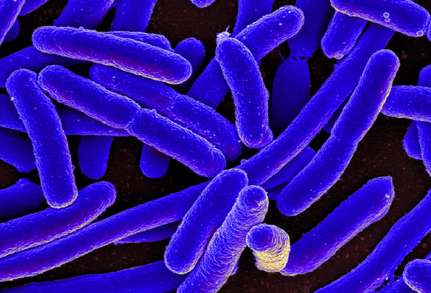 under electron microscope