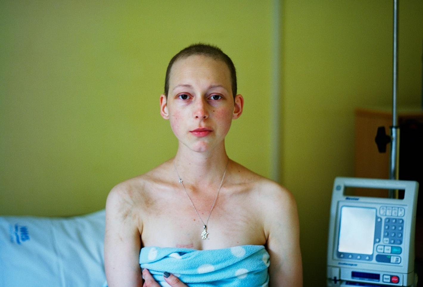 Carly Clarke during chemo