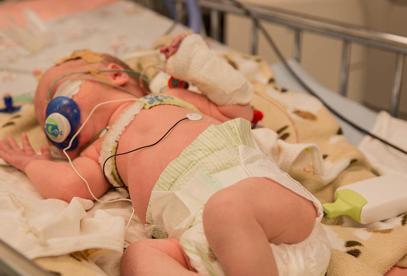 Newborn lying in hospital bed with oxygen