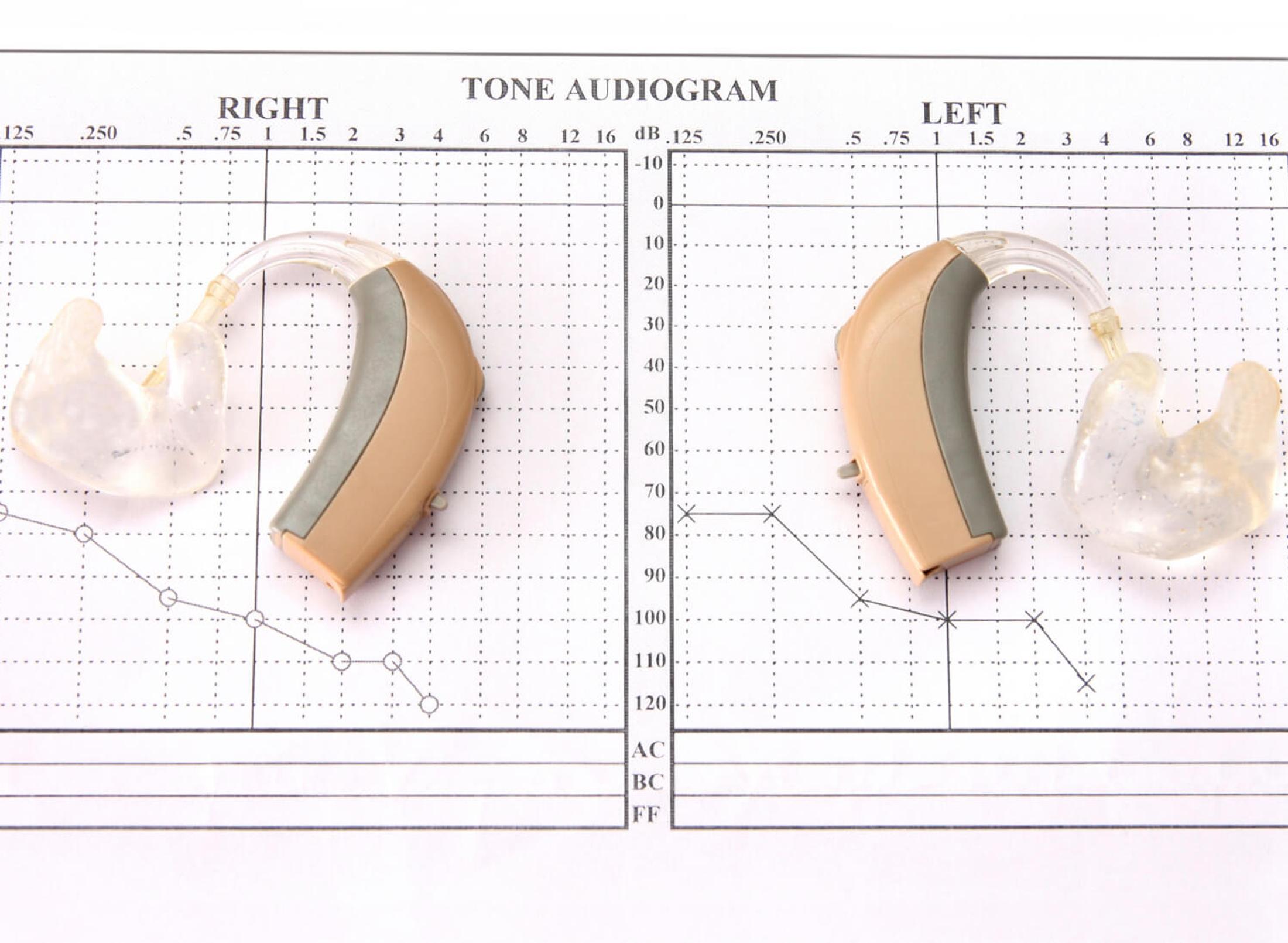 Hearing aids (left and right) placed on a Tone Audiogram