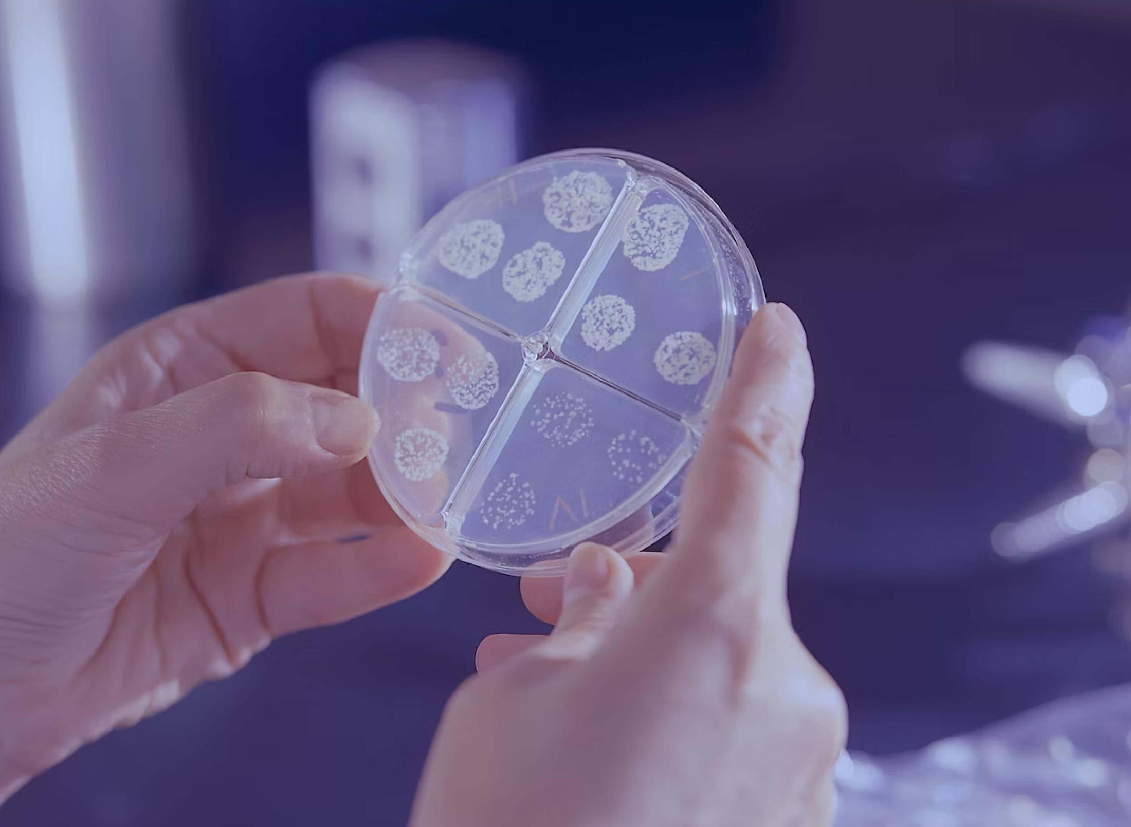 Hands holding a petri dish