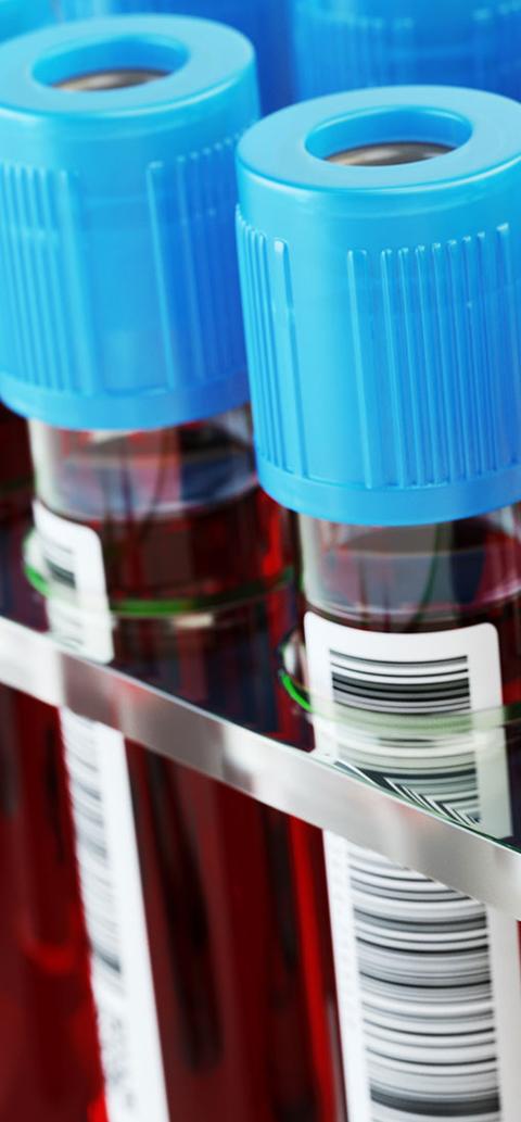 a close up of test tube vials filled with blood