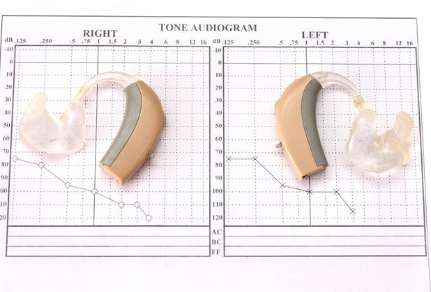 Hearing aids (left and right) placed on a Tone Audiogram
