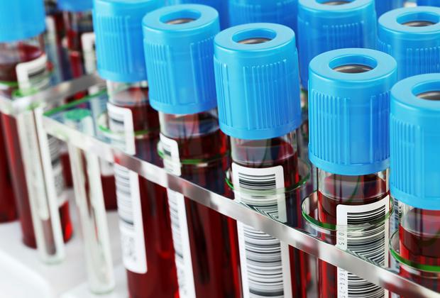 a close up of test tube vials filled with blood