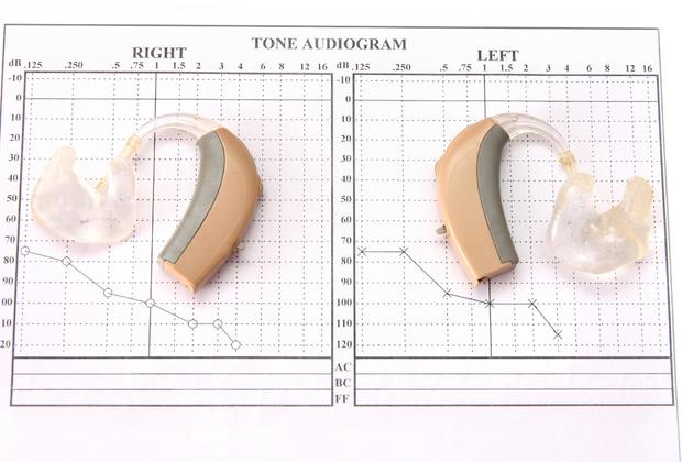 Hearing aids (left and right) placed on a Tone Audiogram