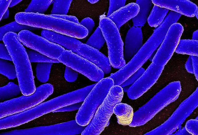 under electron microscope