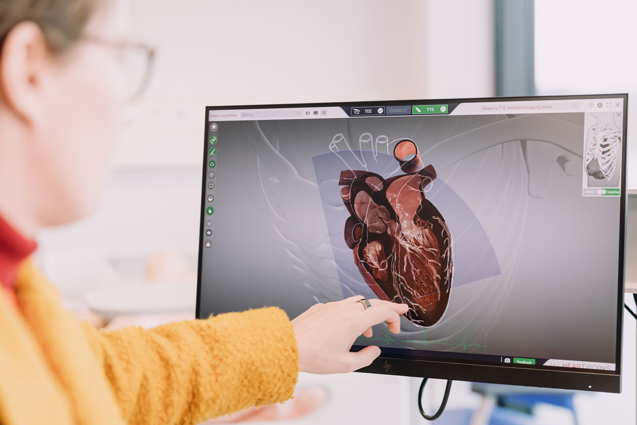 hand pointing to computer monitor with diagram of heart