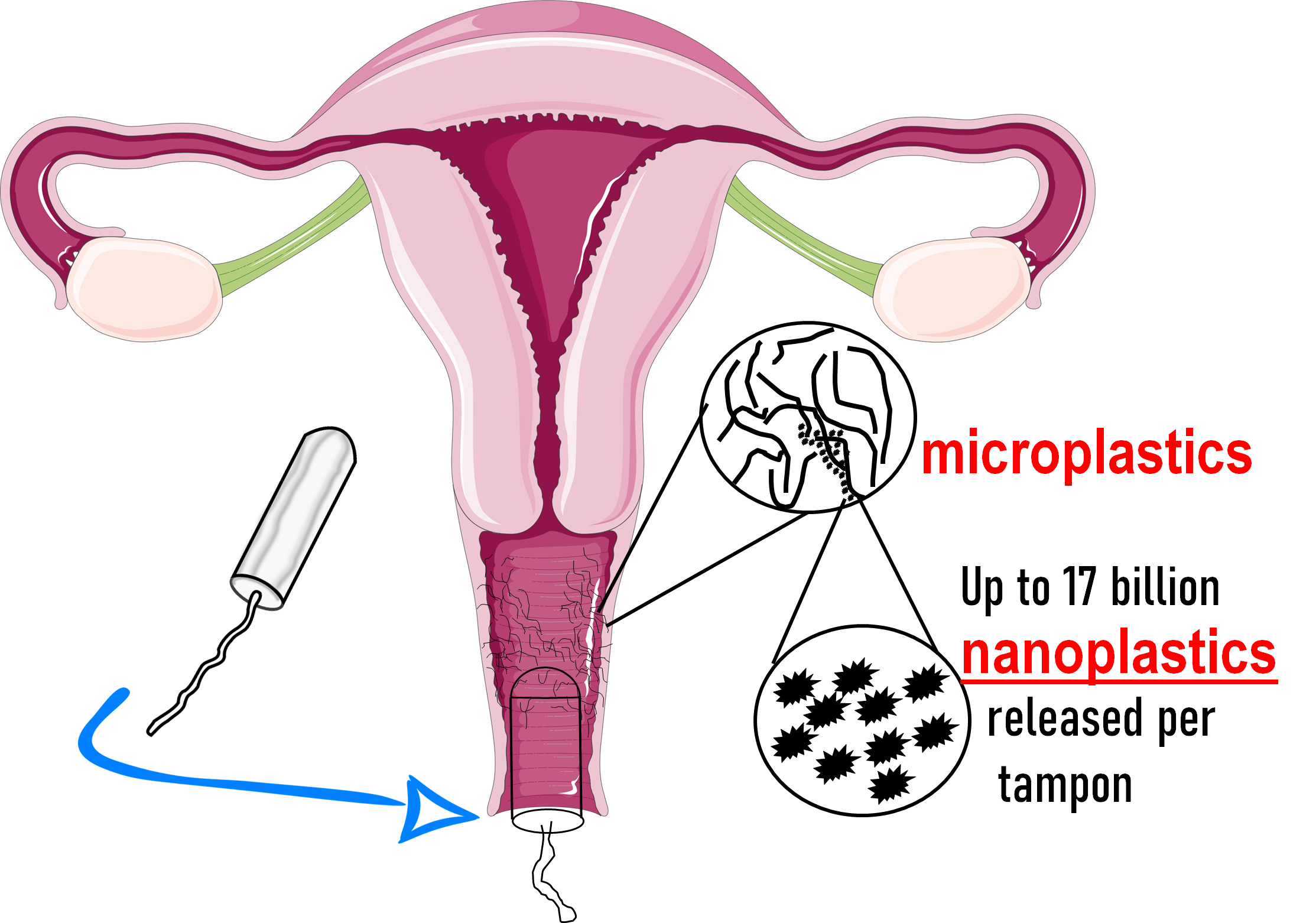 diagram of female reproductive system with tampon and microplastics in vagina area, text: microplastics, up to 17 billion nanoplastics released per tampon